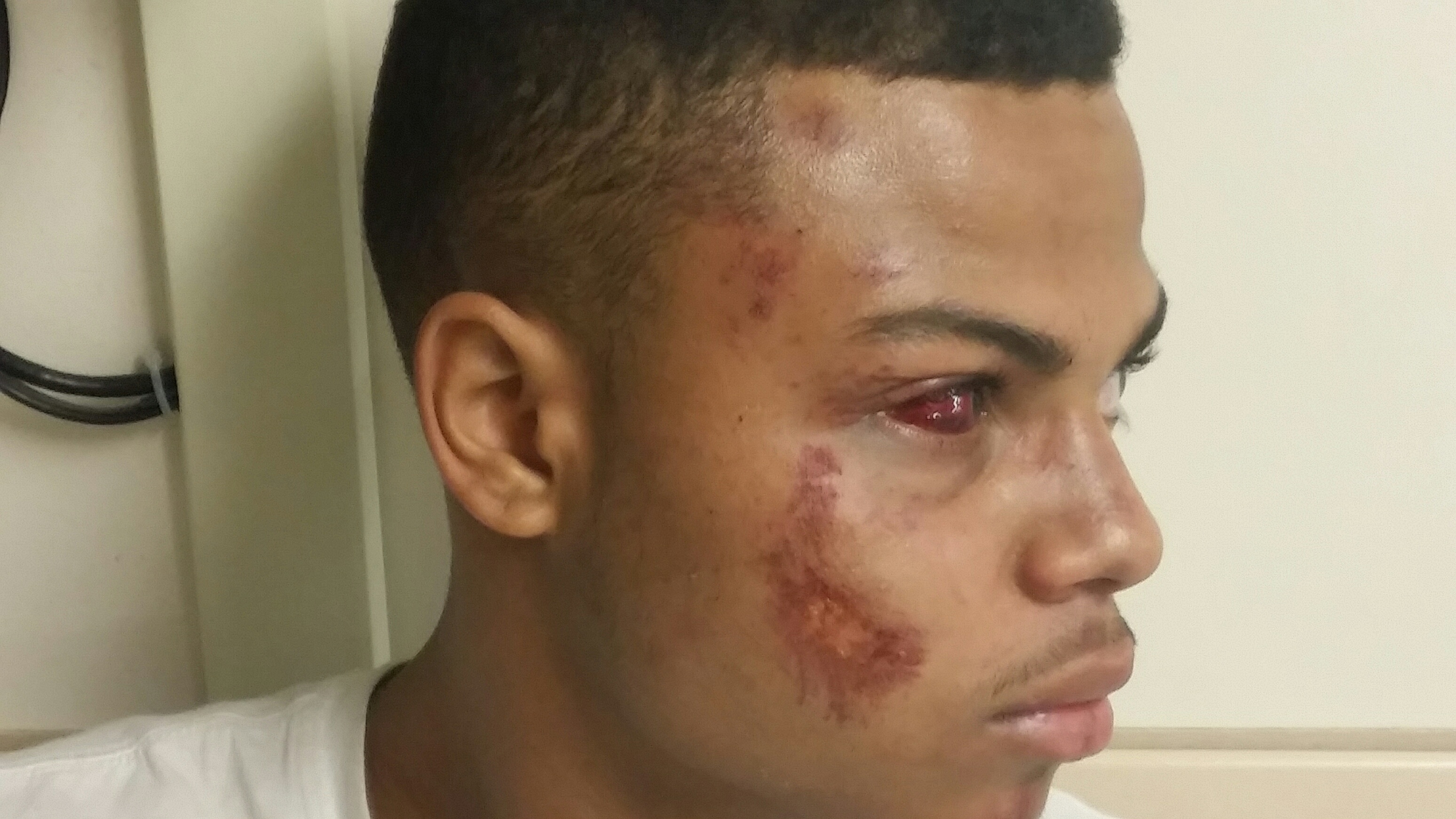 Elijah Johnson was beaten by Syracuse police officers while he was handcuffed - elijah-johnson-side-view